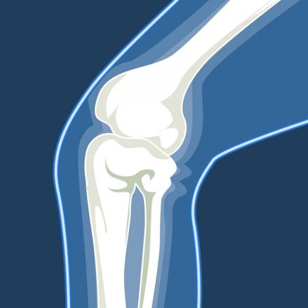 Ízületi problémák