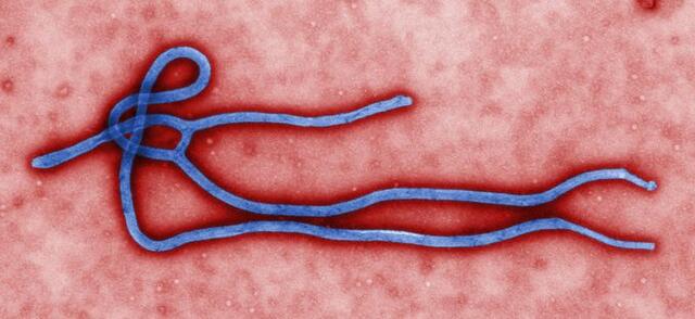 Az ebola két hét alatt végez áldozataival. Az Ebola vírus, ami gyorsan és könnyen változik.