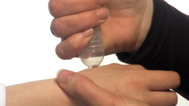 Szemölcs kialakulás az egész testen Szemölcs elterjedés
