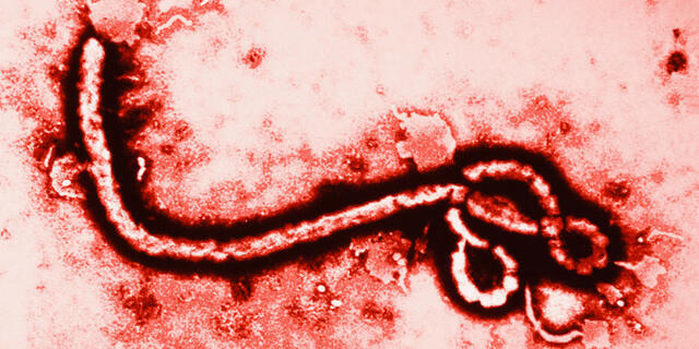 C-vitaminnal megmenekülhetünk az ebolától? Ebola és C-vitamin? Mi köze egymáshoz?