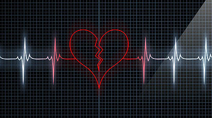 Szív- és érrendszeri betegségek kialakulása
