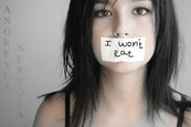 anorexia nervosa anorexia nervosa