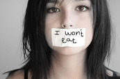 Anorexia nervosa Anorexia nervosa