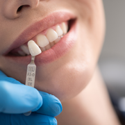 Hogyan lehet pótolni a hiányzó fogat esztétikusan?