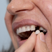 Miért romlik a rágás és az emésztés egy hiányzó fog miatt?