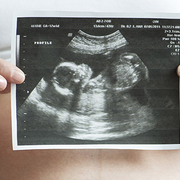 Elfogadták a legújabb, legszigorúbb abortusztörvényt! Elfogadták a legújabb, legszigorúbb abortusztörvényt!