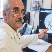 3 órán belül el kell kezdeni kezelni a stroke-ot 3 órán belül el kell kezdeni kezelni a stroke-ot