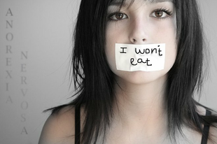 anorexia nervosa anorexia nervosa