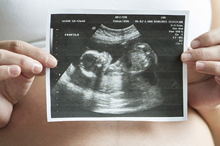 Elfogadták a legszigorúbb abortusztörvényt! Abortusztörvény - abortusz