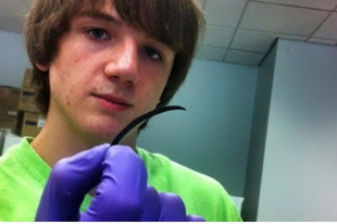 Egy 15 éves fiú,aki új módszert talált fel a rák diagnosztizálására Jack Andraka most elsős a középiskolában, és feltalált egy olyan papírszenzort, ami 5 perc alatt felfedezi a tüdő-, petefészek-, és hasnyálmirigyrákot, és mindez csak körülbelül 3 centbe kerül.